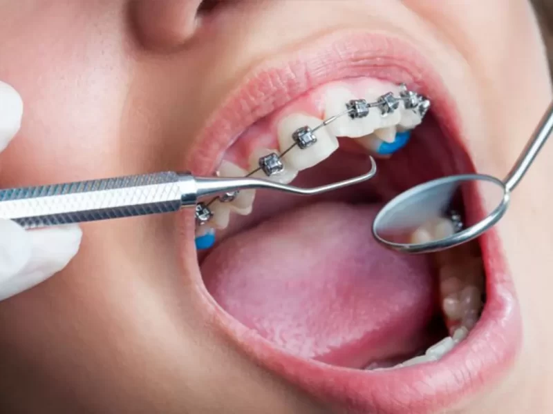 Sabit Ortodonti